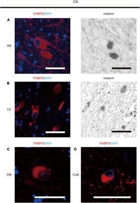 Fatty Acid-Binding Protein 3 Expression in the Brain and Skin in Human Synucleinopathies